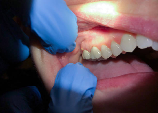 Best Emergency Orthodontic Services in Towanda, KS