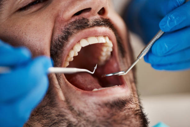 Best Emergency Dental Care for Broken or Chipped Teeth in Towanda, KS