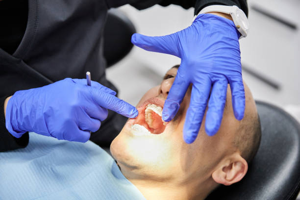 Best Emergency Wisdom Teeth Removal in Towanda, KS